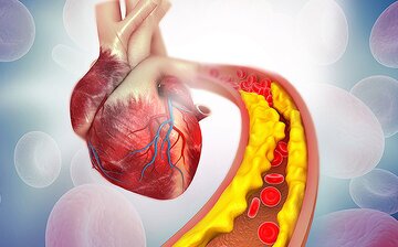 کاهش کلسترول خون با این ماده غذایی